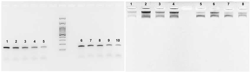 RNA Viral Extraction RT PCR Real Time استخراج ویروسی